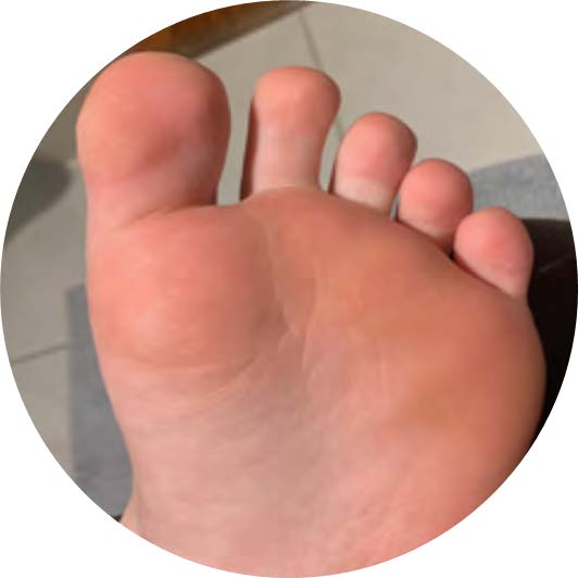 Close-up of a person's healthy foot 